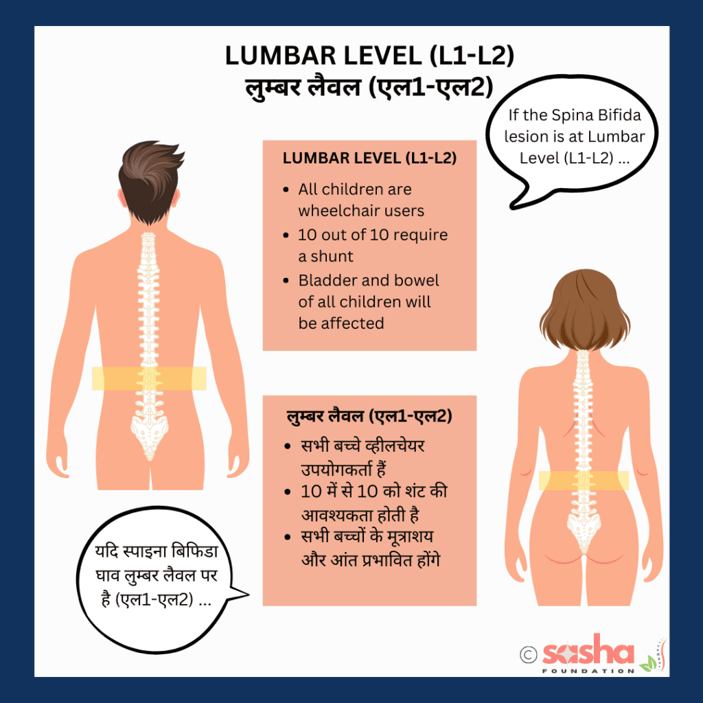 Lumbar-functional-level-l1