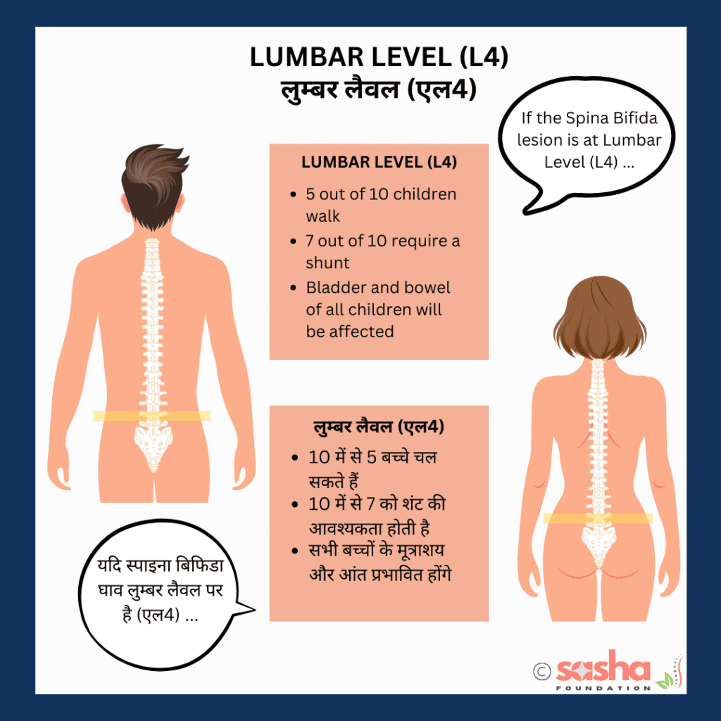 Lumbar-functional-level-l4