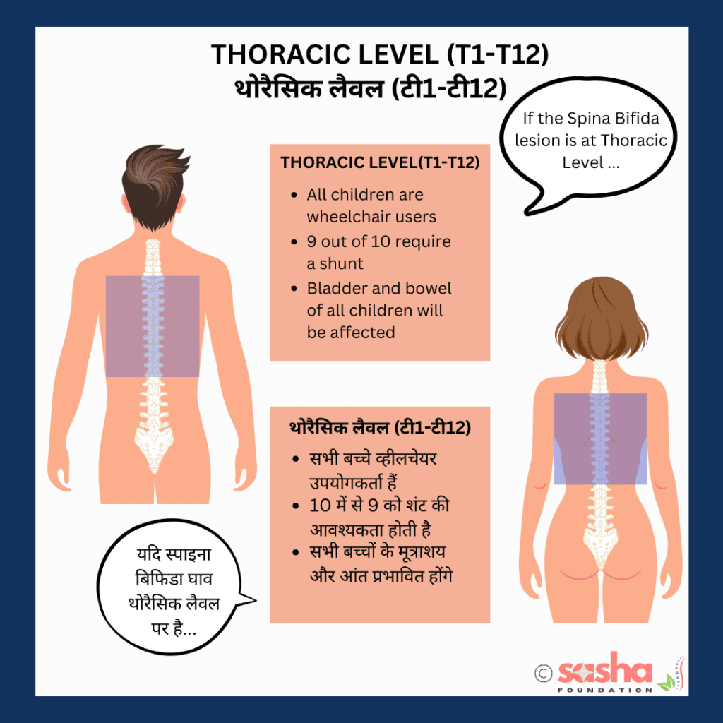 Thoracic-functional-level