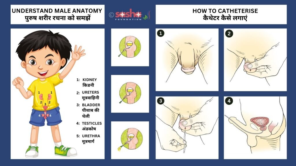 an illustration image showing male anotomy and catheterising steps for male child