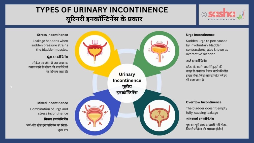 Types of urinary incontinence Types of urinary incontinence