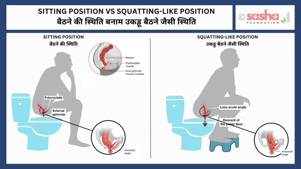 Sitting Position vs Squatting-like Position Squatting like postion with a step stool can help in proper and complete digital evacuation